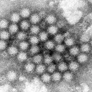 norovirus-infections-things-to-know