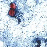 cyclospora-outbreak-history