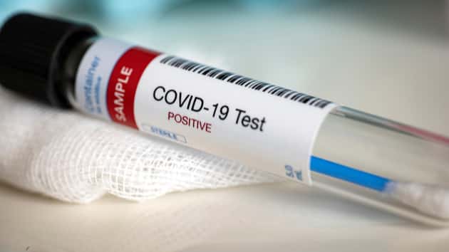 covid-test-positive