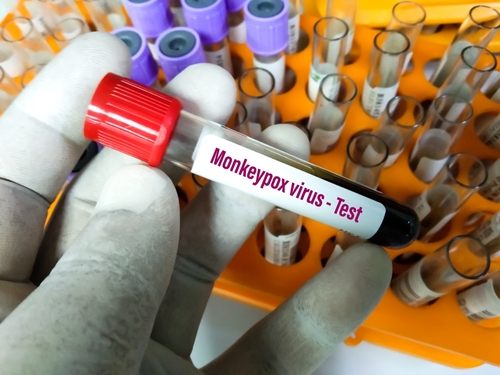 White House Officials Say Risk For Monkeypox Outbreak Is 'Low' - Vimarsana News