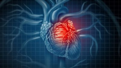 UT researchers win grant to develop technology to better assess heart attack risks