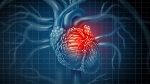 UT researchers win grant to develop technology to better assess heart attack risks