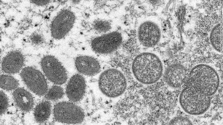 Travis County Confirms First Presumptive Monkeypox Case