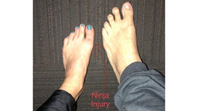 side by side comparison of deb and jason's feet
