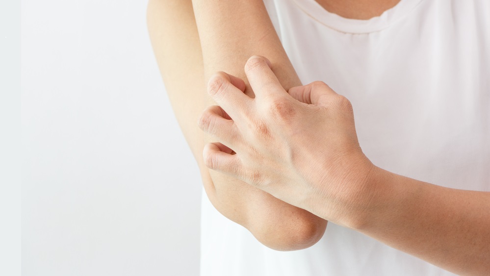 stock photo of someone scratching their arm