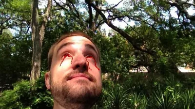 cj morgan eyes bleeding watching eclipse