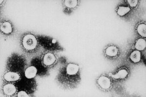 This undated handout photo from the Centers for Disease Control and Prevention (CDC) shows a microscopic view of the Coronavirus at the CDC in Atlanta, Georgia.