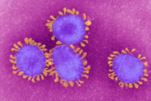 A photo of what the coronavirus looks like under a microscope.