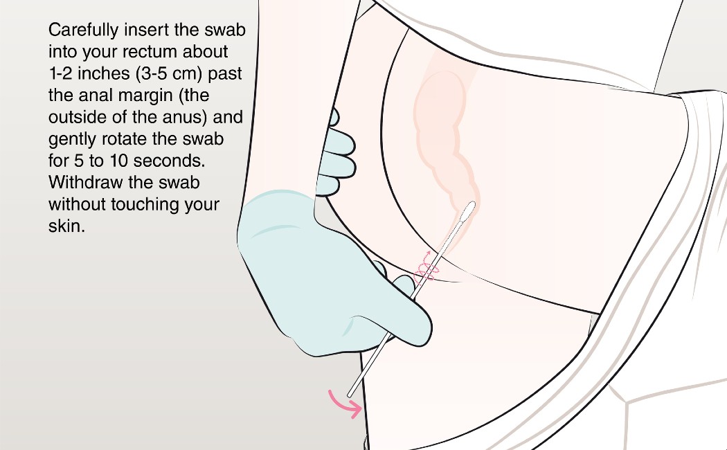 Carefully insert the swab into your rectum about 1-2 inches (3-5 cm) past the anal margin (the outside of the anus) and gently rotate the swab for 5 to 10 seconds.