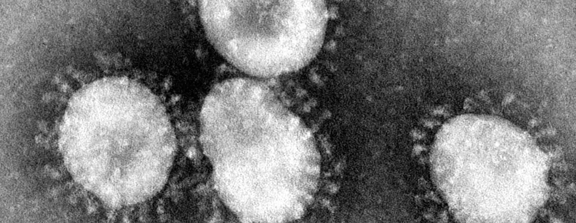 coronaviruses-jpg-5