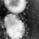 coronaviruses-jpg-40