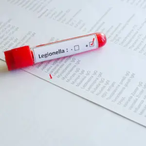 legionella-positive