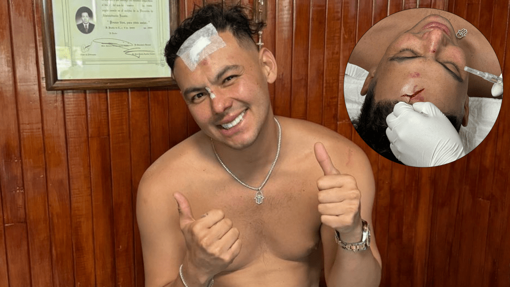 el-yaki-accidente