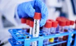 Scientist^ hand and bacteria sample in test tube^ person in lab with medical research and healthcare study. Doctor^ gloves and vaccine^ check legionella sample closeup and scientific experiment