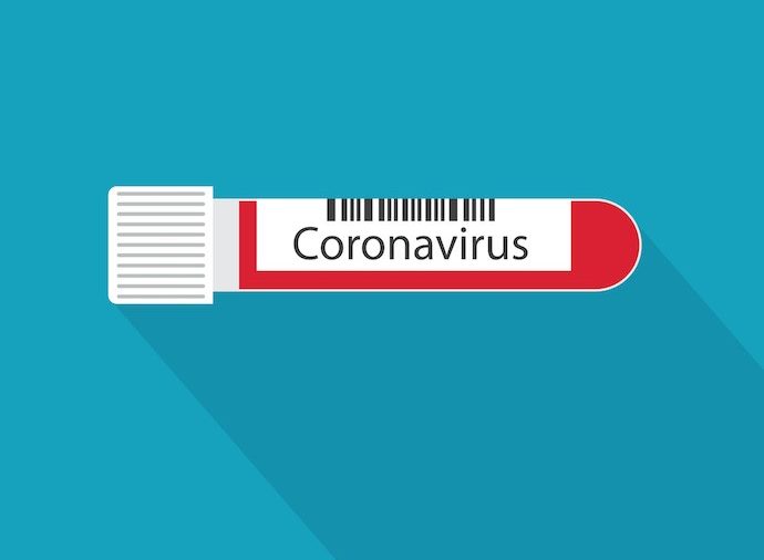 coronavirus-testing