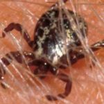 tick-mdc-150x150-1