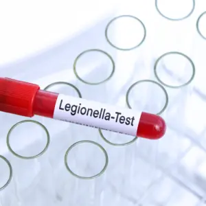 legionella-3-1