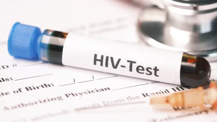 hiv-blood-test-tube-and-prescription-on-table