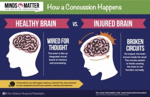 how-concussion-happens-infographic-e1384469086321