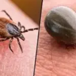 Tick Bites Setting Record Highs