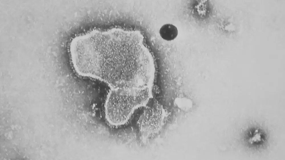 nys-shows-record-high-child-flu-deaths-measles-increase819005