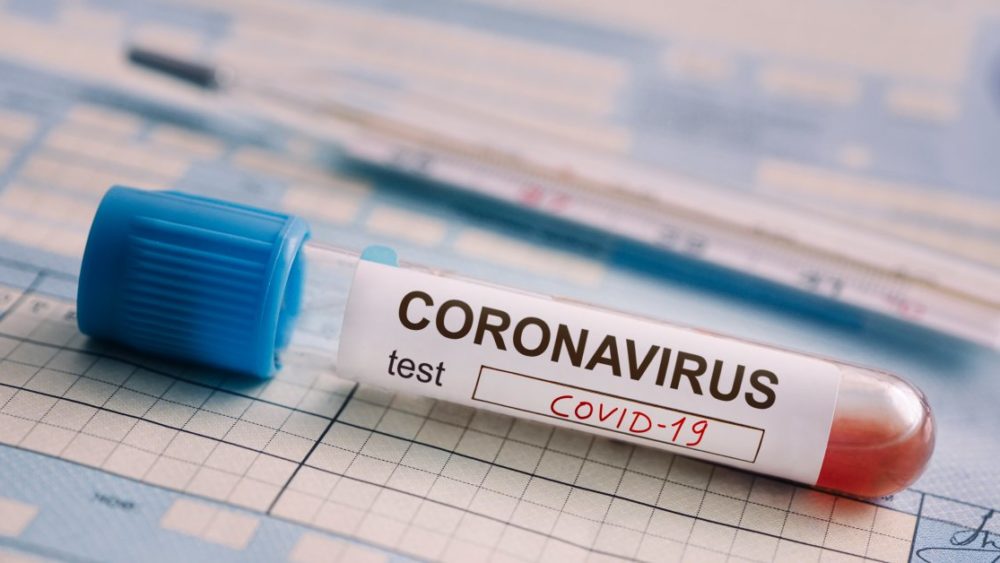 test-tube-with-the-blood-test-is-on-the-table-next-to-the-documents-positive-test-for-coronavirus-covid-19-concept-of-fighting-a-dangerous-chinese-disease