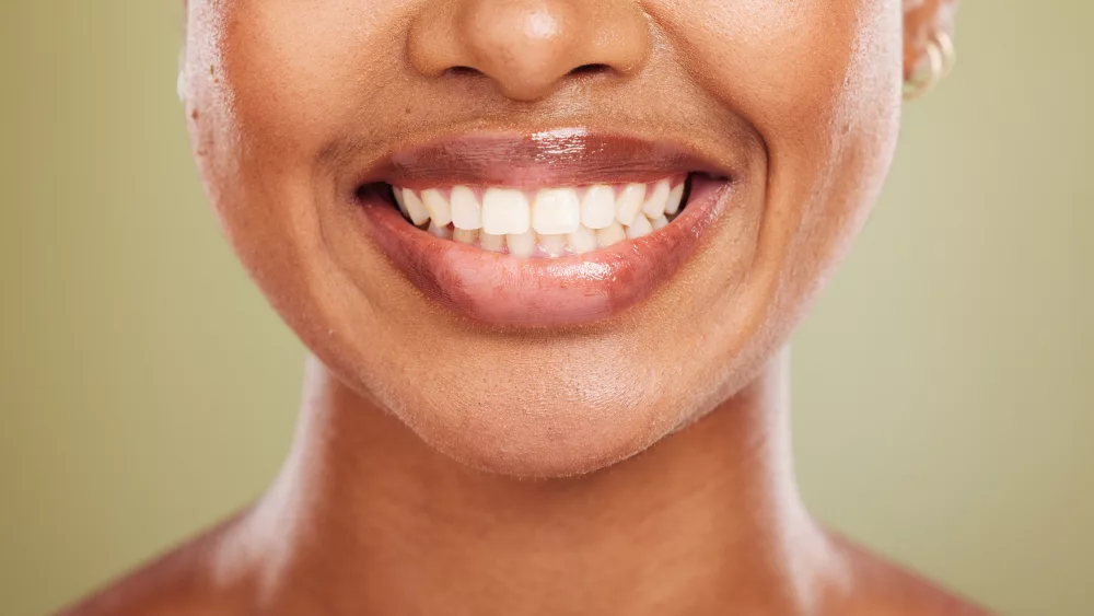 smile-teeth-and-mouth-of-black-woman-closeup-on-s-2023-11-27-05-04-42-utc
