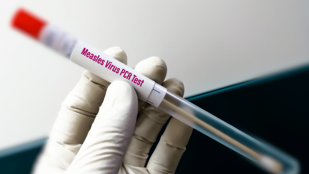 measles-test