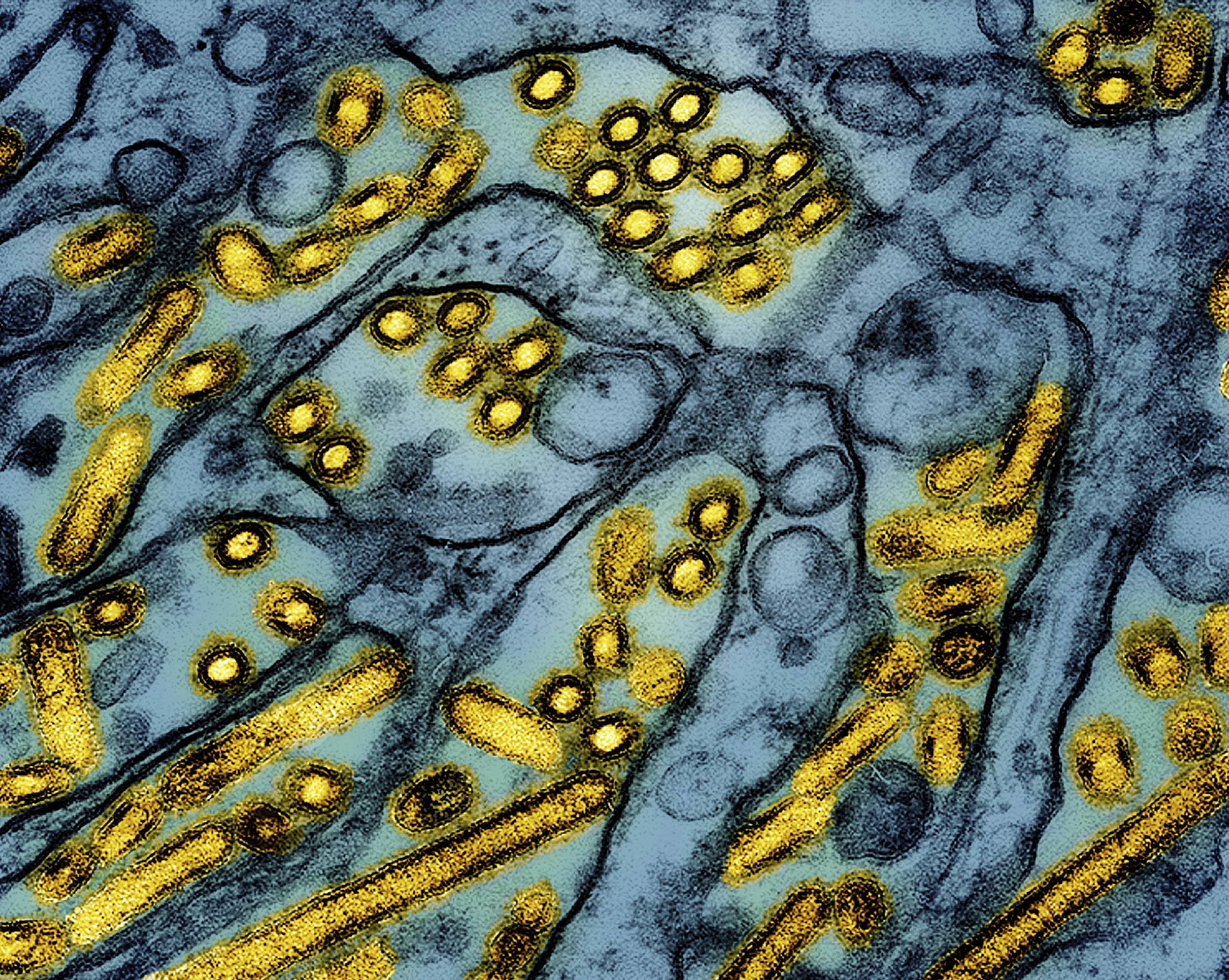 bird-flu-ap-photo-jpg-3