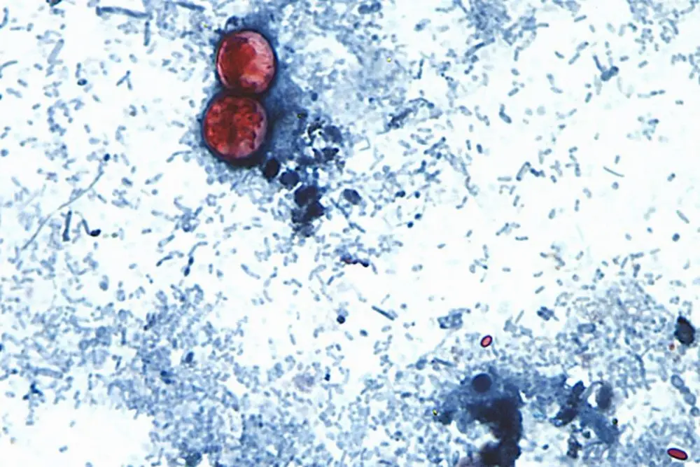 cyclospora-ap-photo-jpg-9