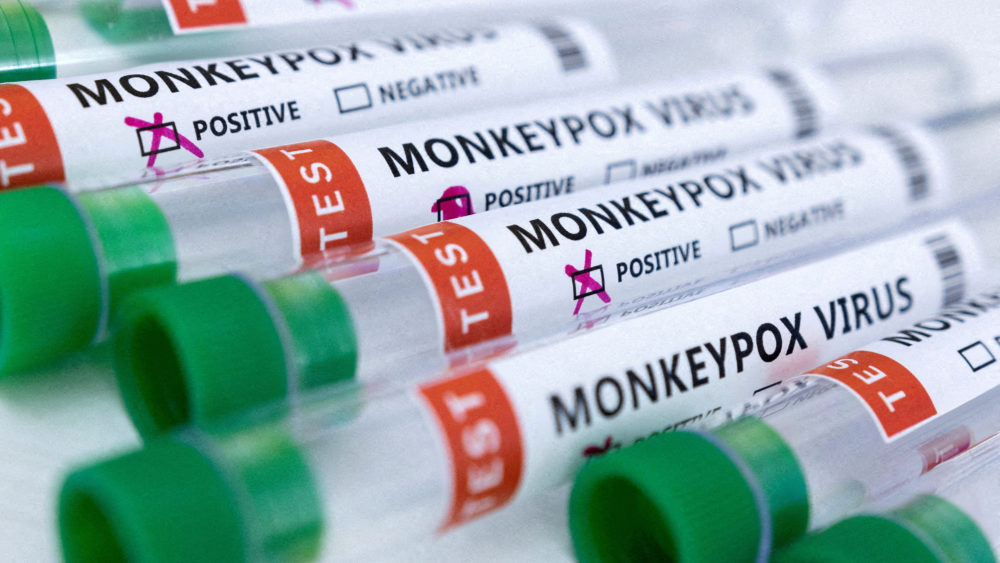 file-photo-illustration-shows-test-tubes-labelled-monkeypox-virus-positive-and-negative