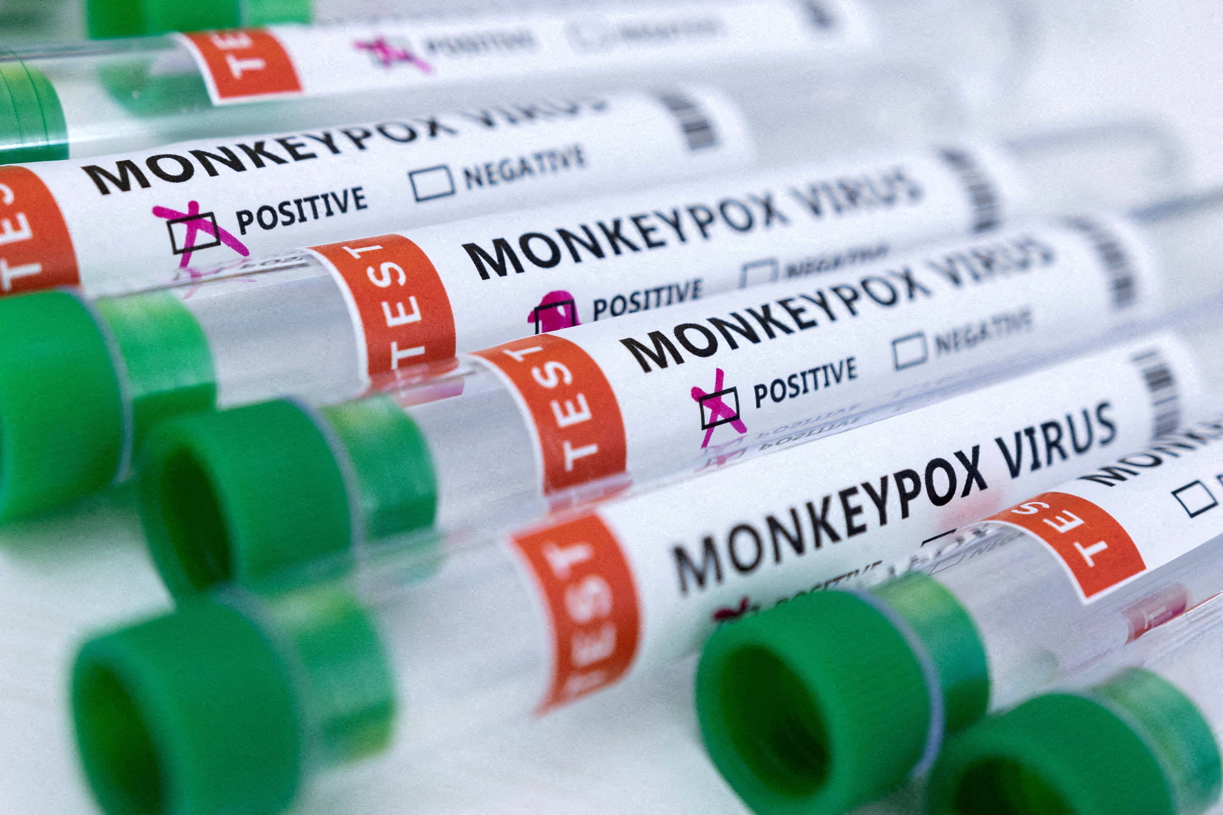 file-photo-illustration-shows-test-tubes-labelled-monkeypox-virus-positive-and-negative