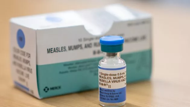 gettyimages-2202122580measles431303