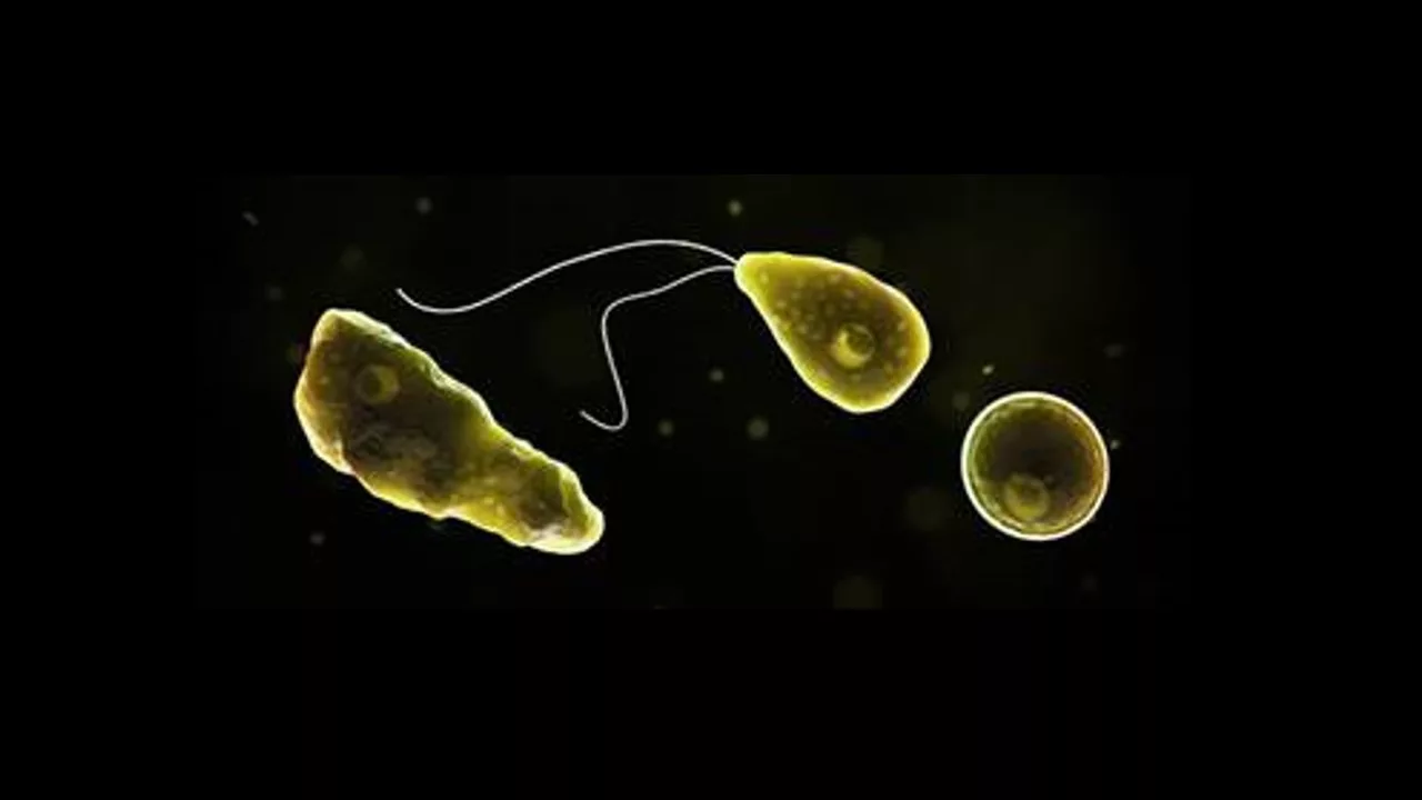 rare-brain-eating-amoeba-jpg-3