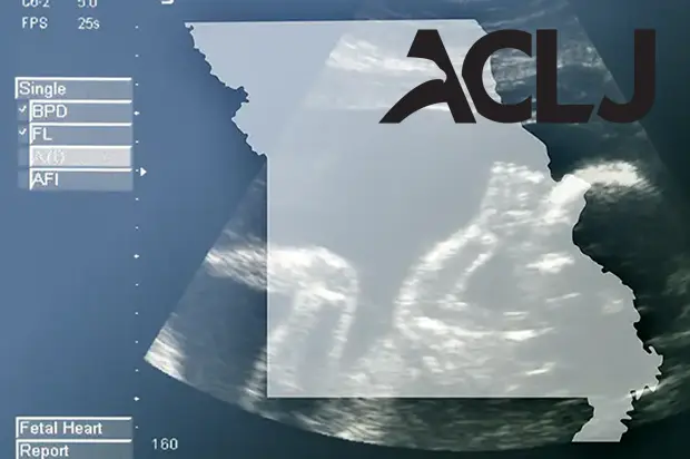 missouri_ultra_sound-blog-post-1