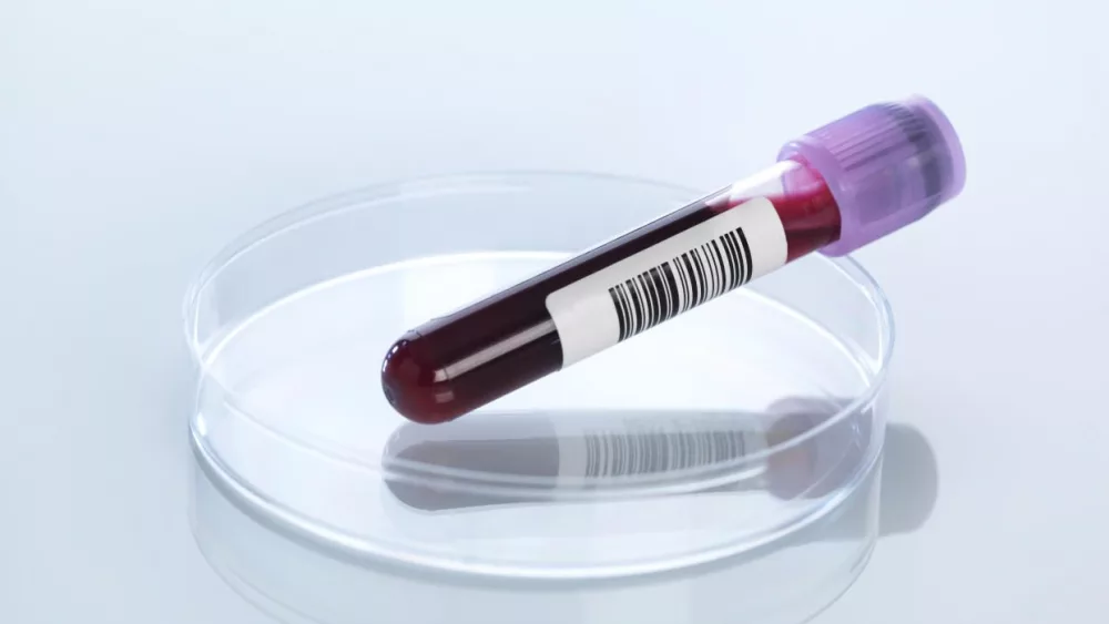 blood-screening