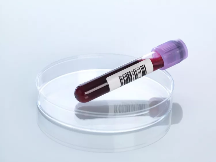 blood-screening