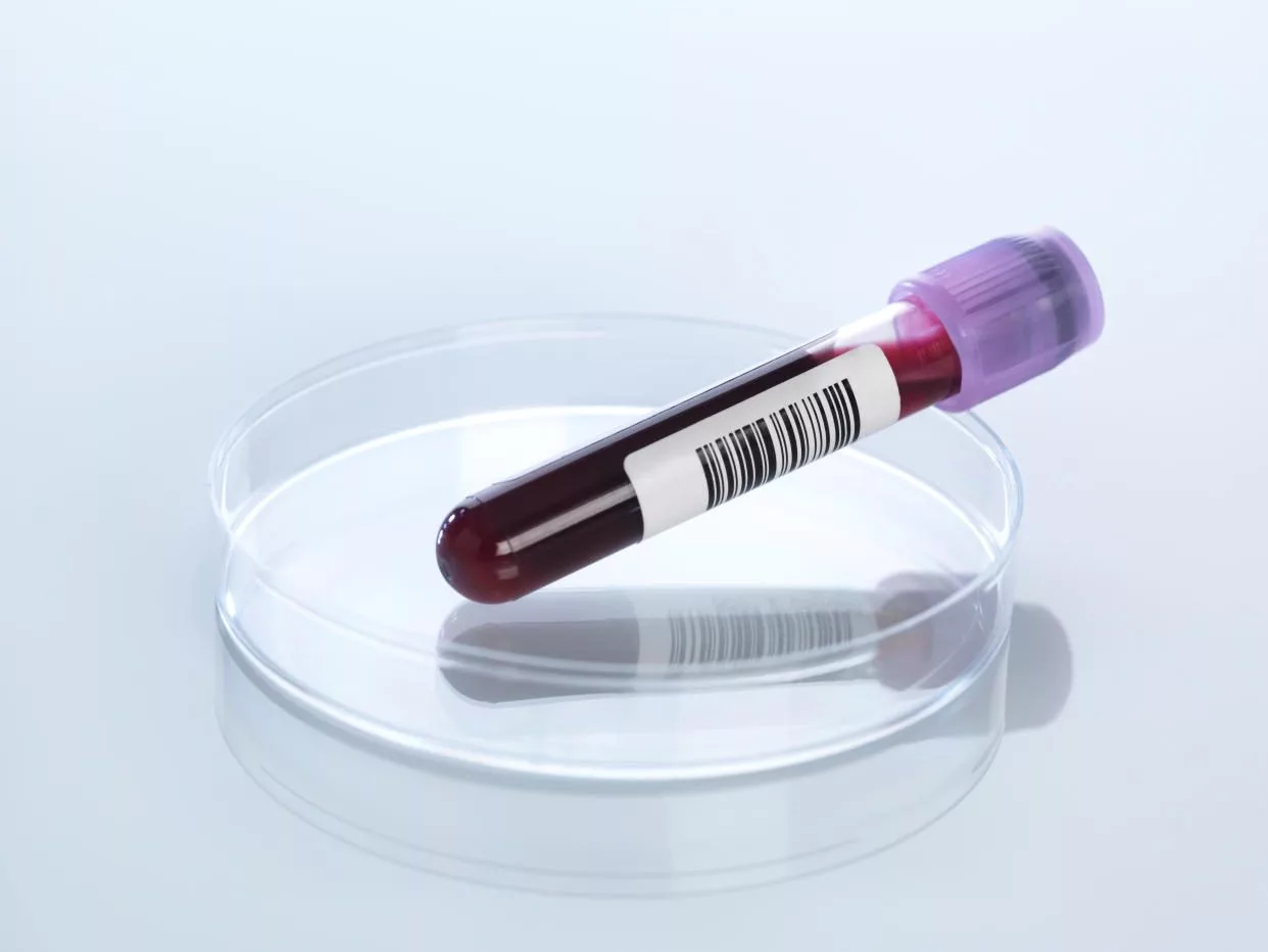 blood-screening