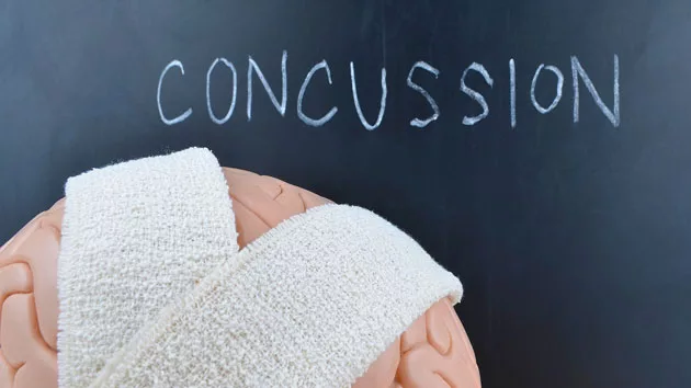 getty_053116_concussion773116