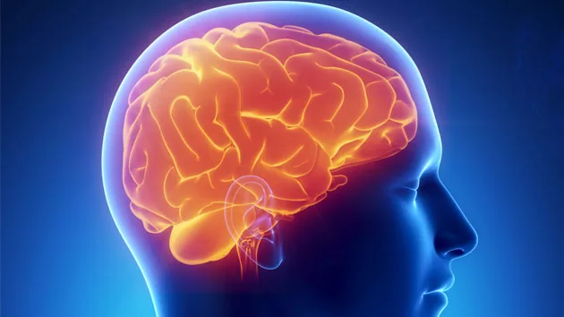 getty_111615_brain400801