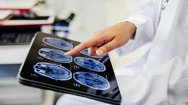 getty_061224_doctorlookingatmri-stock816305