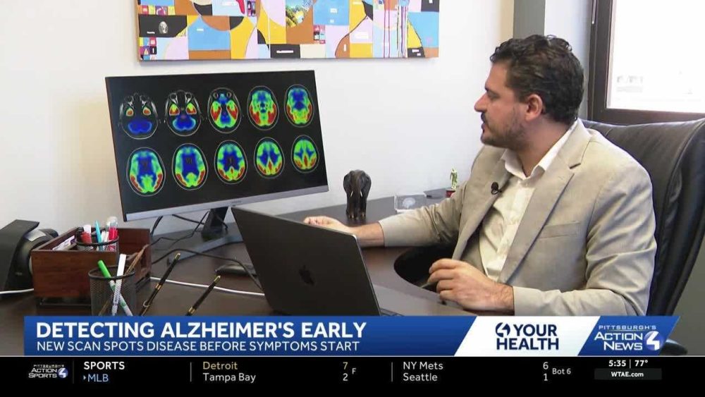 Researchers develop new imaging test to help detect Alzheimer’s with greater accuracy