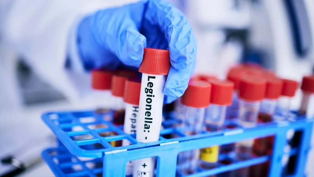 Scientist^ hand and bacteria sample in test tube^ person in lab with medical research and healthcare study. Doctor^ gloves and vaccine^ check legionella sample closeup and scientific experiment