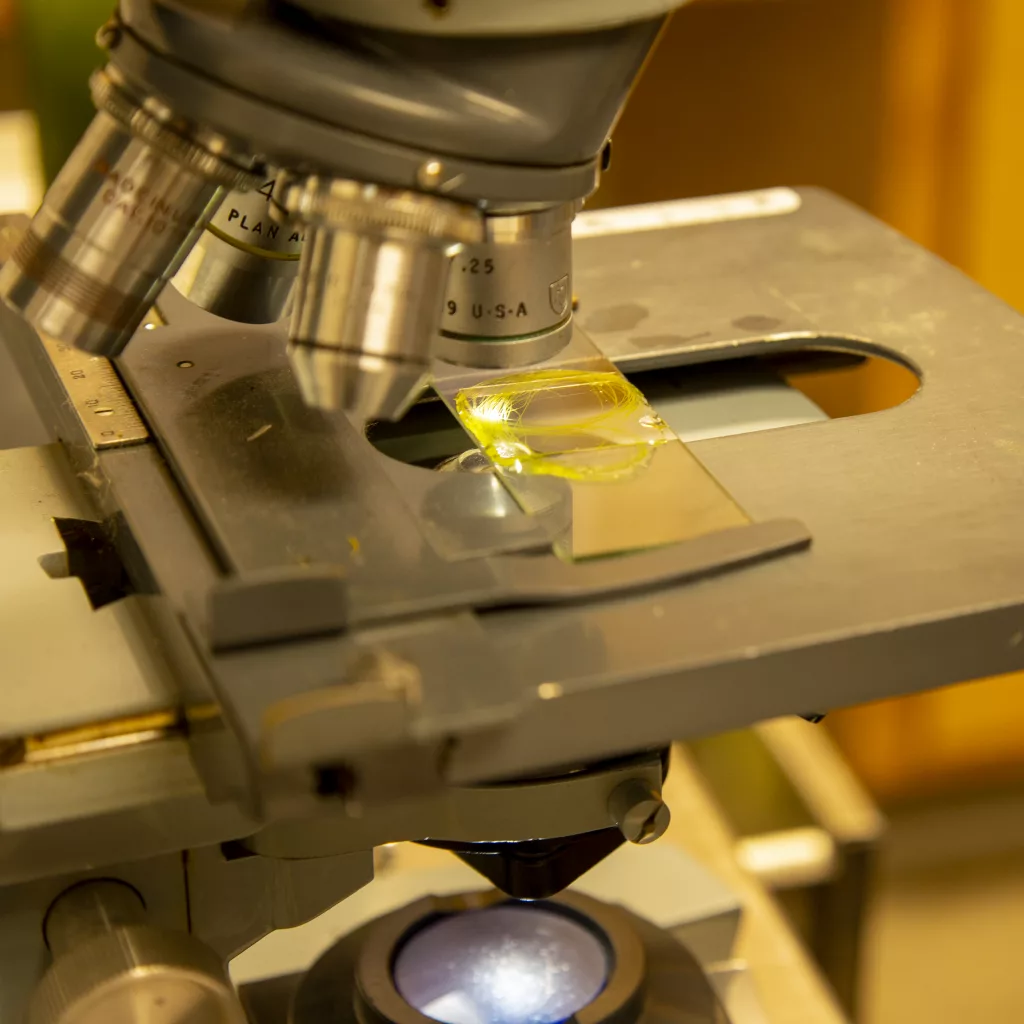 pond-management_water-sample-with-algae-under-microscope