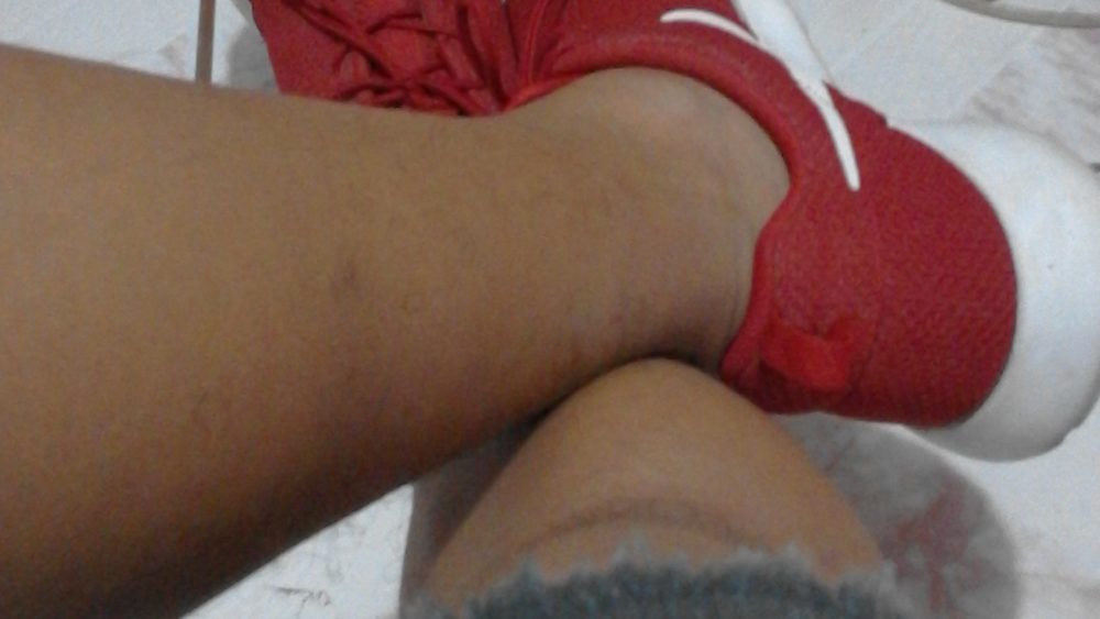 sneakers