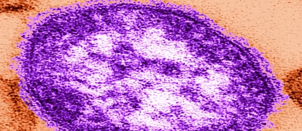 Person who traveled last week through Maryland had measles, state health officials say