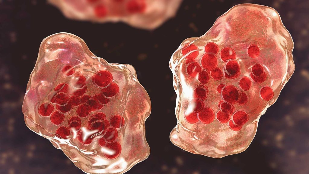Maryland confirms 13th measles case after possible exposure at Elkton hospital