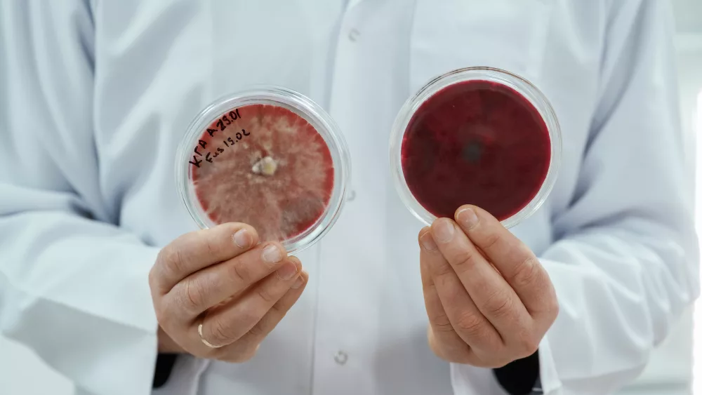 lab-worker-is-holding-containers-with-trichoderma-and-sclerotinia