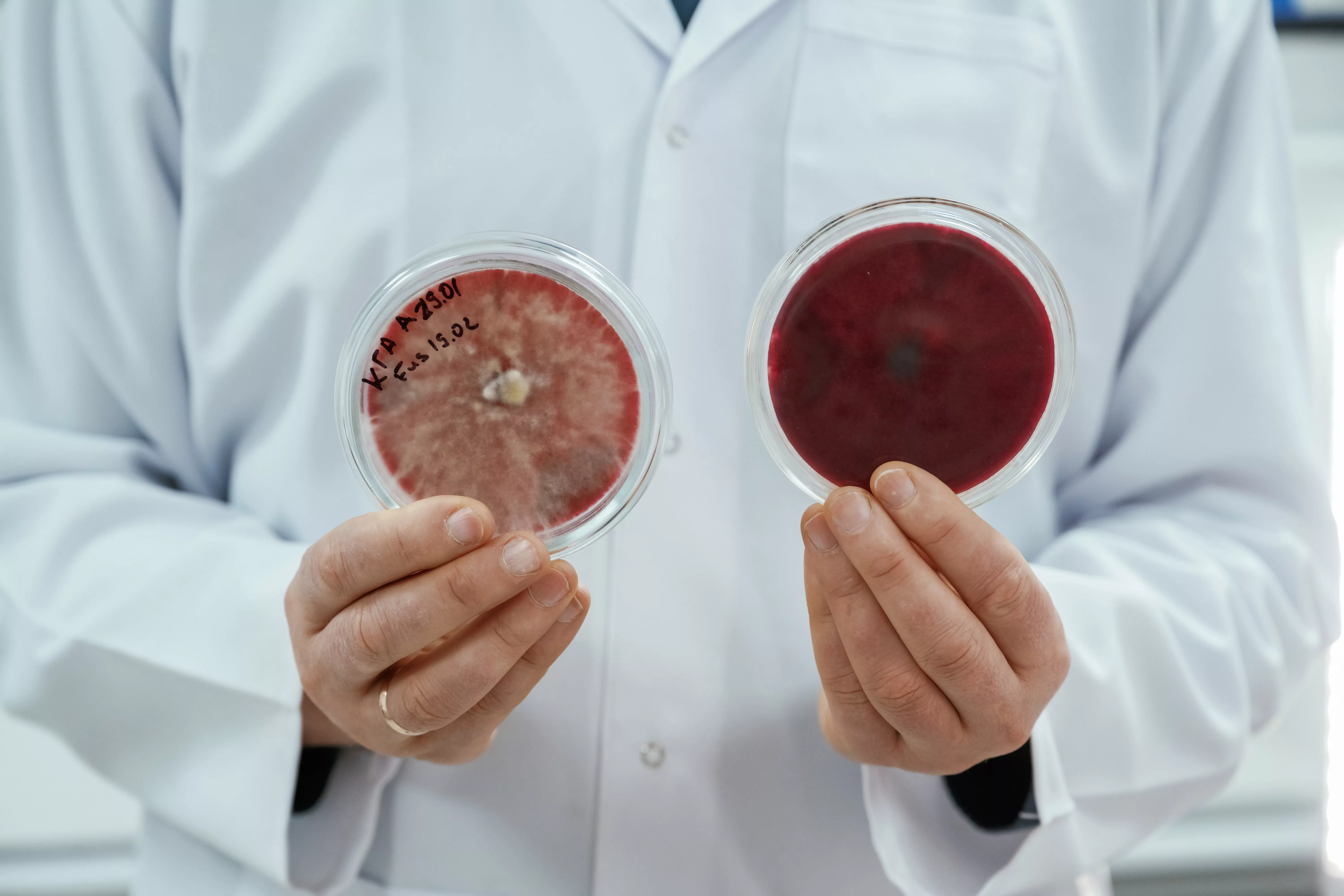lab-worker-is-holding-containers-with-trichoderma-and-sclerotinia