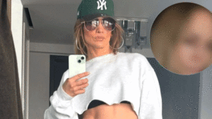 er